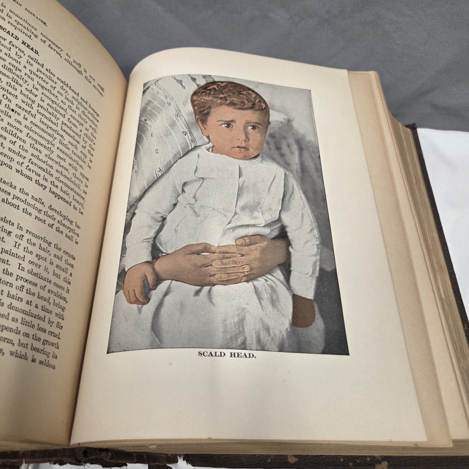 Medicology or Home Encyclopedia of Health 1906 Joseph Richardson 10 volumes in 1