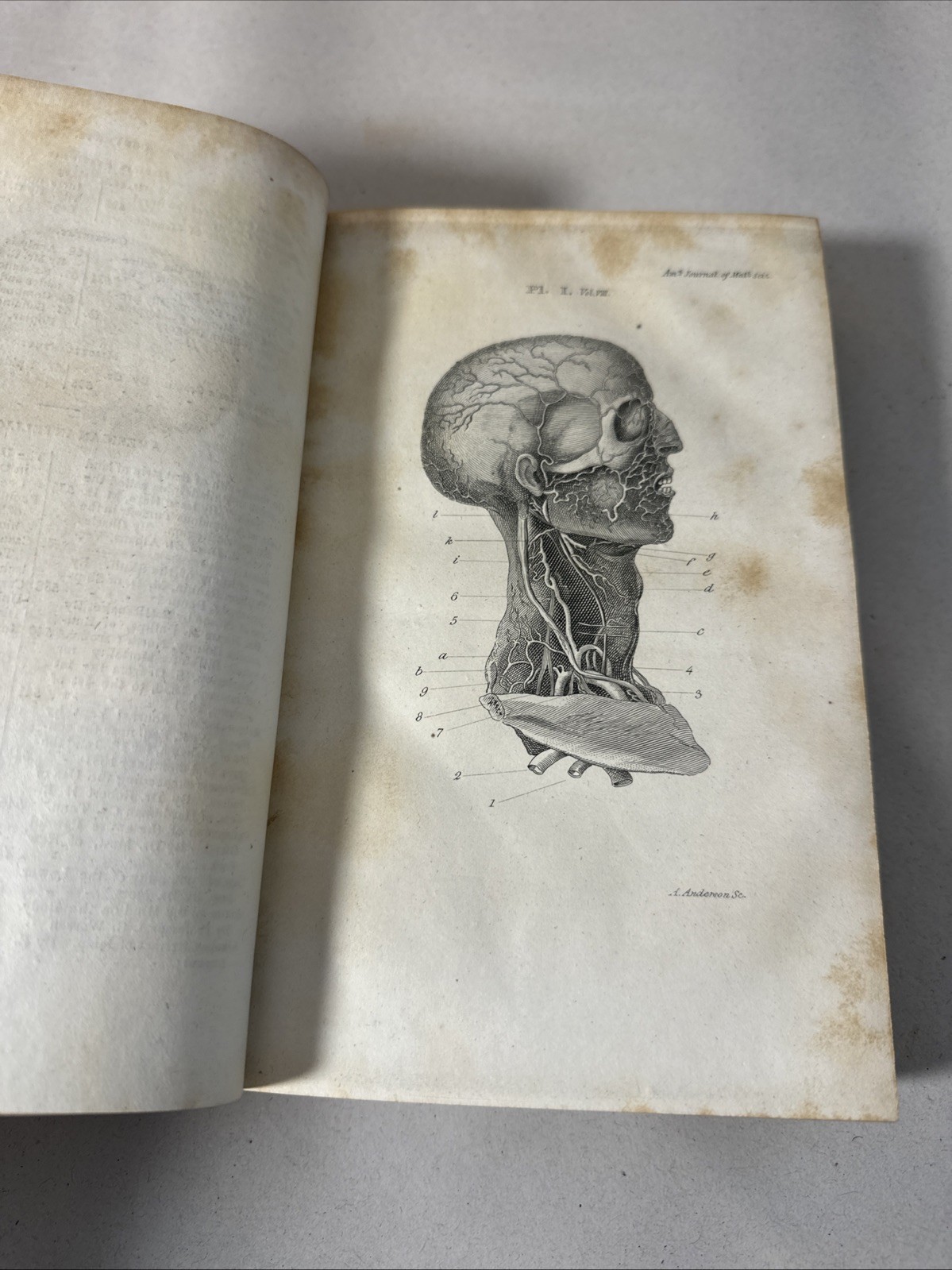American Journal Medical Sciences 1831 First Edition Book Plates Volume 8