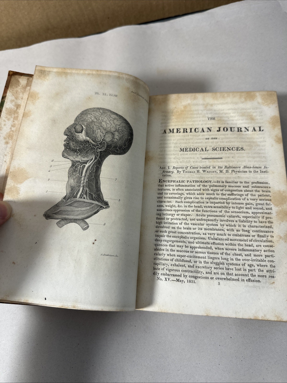 American Journal Medical Sciences 1831 First Edition Book Plates Volume 8